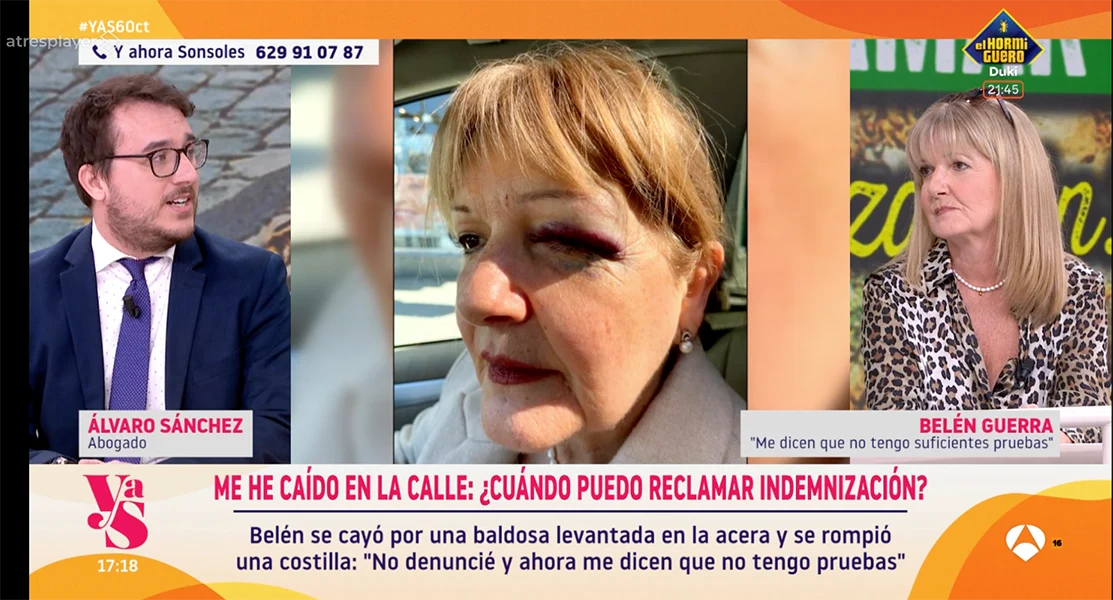 Legalion Abogados resuelve las dudas sobre la Responsabilidad Patrimonial de los ayuntamientos tras accidentes